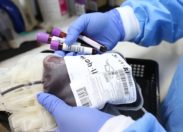 Covid-19: Plasma convalescente per rallentare l’epidemia